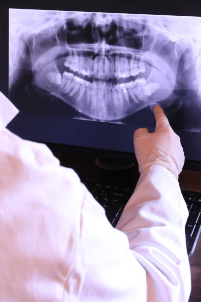 Best Emergency Root Canal Treatment in Hinesville, GA