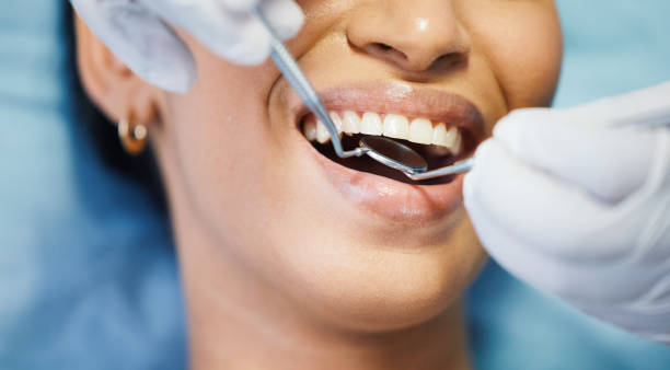 Best Emergency Tooth Extraction in Hinesville, GA